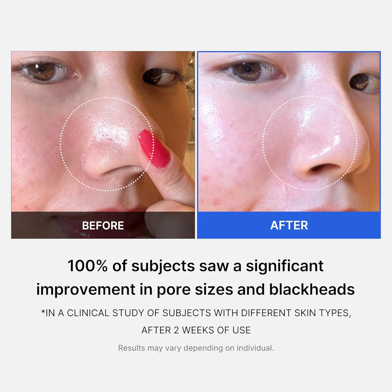 Medicube Dual-Textured Zero Pore Pads 2.0 | Gentle Daily Exfoliating Toner Wipes