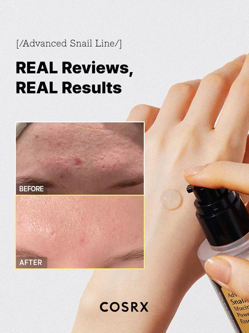 COSRX Advanced Snail 96 Mucin Power Essence – Hydrating & Repairing Korean Skincare Serum
