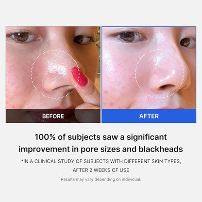 Medicube Dual-Textured Zero Pore Pads 2.0 | Gentle Daily Exfoliating Toner Wipes
