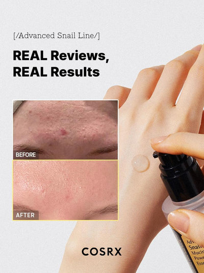 COSRX Advanced Snail 96 Mucin Power Essence – Hydrating &amp; Repairing Korean Skincare Serum